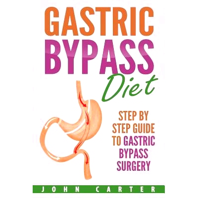 预订 Gastric Bypass Diet: Step By Step Guide to Gastric Bypass Surgery
