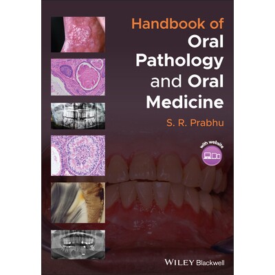 预订 Handbook of Oral Pathology and Oral Medicine 口腔病理学与口腔医学手册: 9781119781127