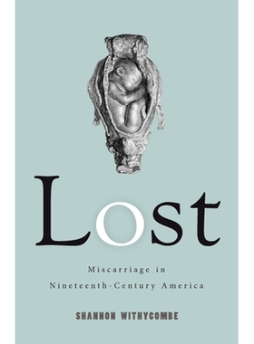 预订 Lost: Miscarriage in Nineteenth-Century America 迷失：19世纪美国的流产: 9780813591544