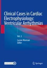 [预订]Clinical Cases in Cardiac Electrophysiology: Ventricular Arrhythmias 9783031355783