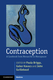 【预订】Contraception