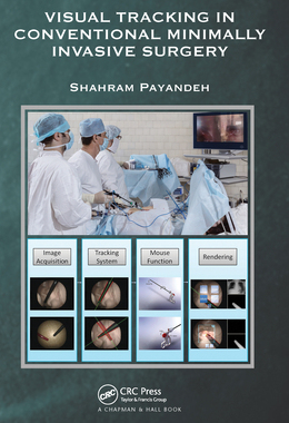 【预订】Visual Tracking in Conventional Minimally Invasive Surgery