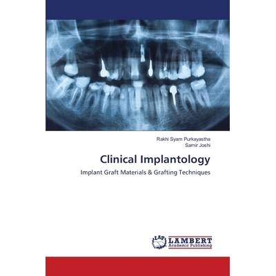 预订 Clinical Implantology 临床移植学: 9786202917728