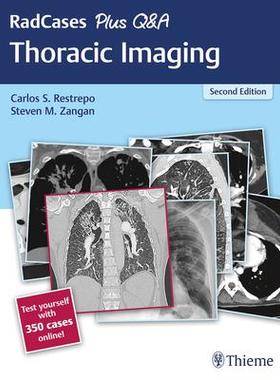 [预订]RadCases Plus Q&A Thoracic Imaging 9781626238145