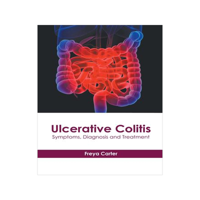 [预订]Ulcerative Colitis: Symptoms, Diagnosis and Treatment 9781632419125