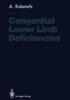 【预订】Congenital Lower Limb Deficiencies