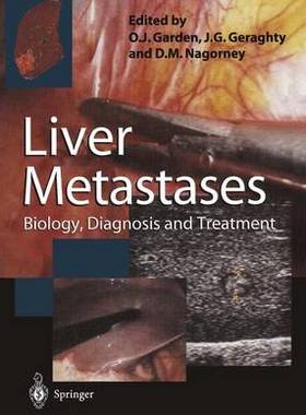 预订 Liver Metastases