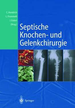 预订 Septische Knochen-und Gelenkchirurgie