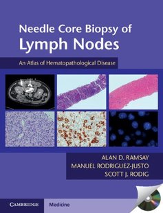Lymph ROM Needle DVD with Nodes Biopsy Core 预订