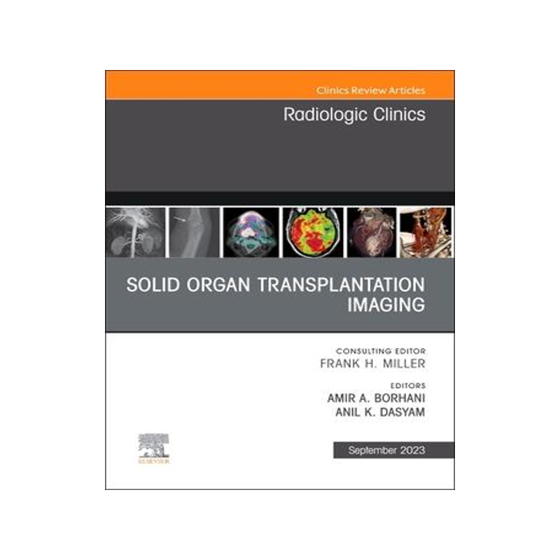 [预订]Solid Organ Transplantation Imaging, an Issue of Radiologic Clinics of North America 9780443181771