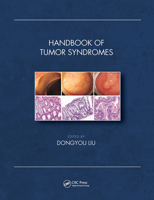 【预订】Handbook of Tumor Syndromes 9781032400044