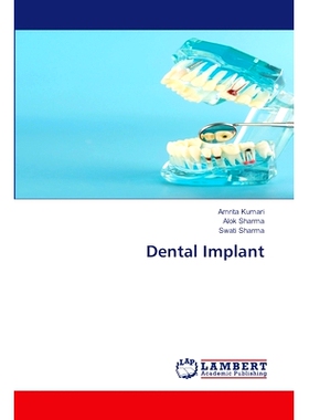 预订 Dental Implant: 9786207640164