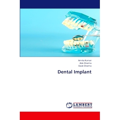 预订 Dental Implant: 9786207640164