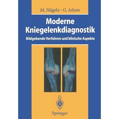 预订 Moderne Kniegelenkdiagnostik: Bildgebende Verfahren und klinische Aspekte: 9783642786280