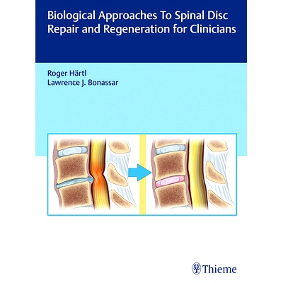预订 Biological Approaches to Spinal Disc Repair and Regeneration for Clinicians 临床医生脊柱椎间盘修复与再生的生物学方