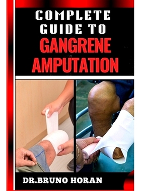 预订 Complete Guide to Gangrene Amputation: Comprehensive Handbook To Diagnosis, Prevention, Treatment, And Recovery Str