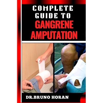 预订 Complete Guide to Gangrene Amputation: Comprehensive Handbook To Diagnosis, Prevention, Treatment, And Recovery Str