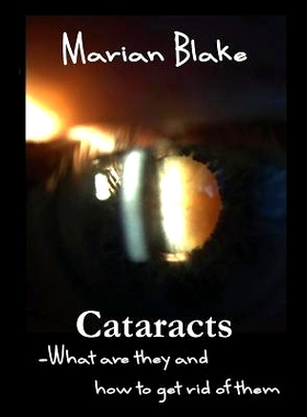 预订 Cataracts: What are they and how to get rid of them?: 9781507738795