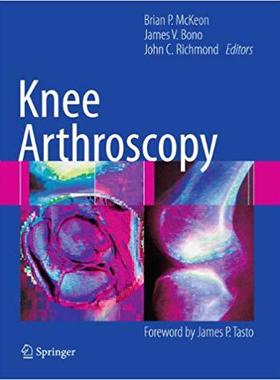【预订】Knee Arthroscopy
