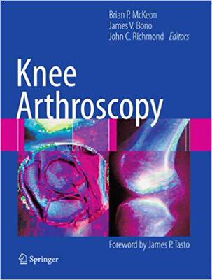 【预订】Knee Arthroscopy