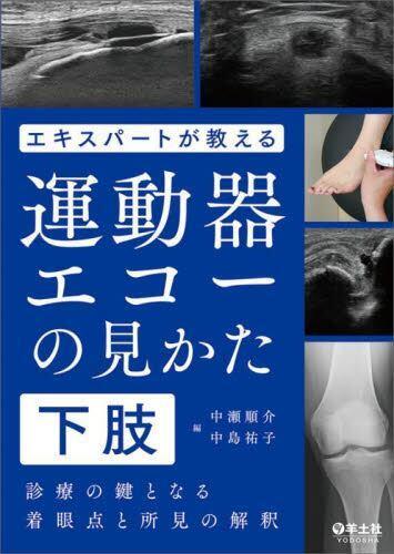 [预订]エキスパートが教える運動器エコーの見かた診療の鍵となる着眼点と所見 9784758111935