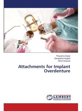 预订 Attachments for Implant Overdenture: 9786139853588