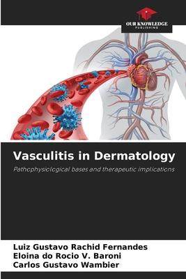 [预订]Vasculitis in Dermatology 9786206201342