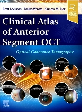 预订 Clinical Atlas of Anterior Segment OCT: Optical Coherence Tomography: 9780443120466