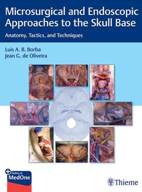[预订]Microsurgical and Endoscopic Approaches to the Skull Base 9781626239661