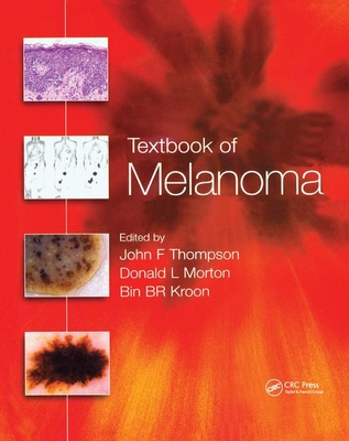 【预订】Textbook of Melanoma