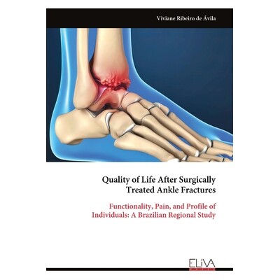 预订 Quality of Life After Surgically Treated Ankle Fractures: Functionality, Pain, and Profile of Individuals: A Brazil
