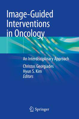 [预订]Image-Guided Interventions in Oncology 9783030487690