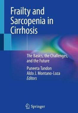 预订 Frailty and Sarcopenia in Cirrhosis