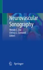 【预订】Neurovascular Sonography 9783030968922