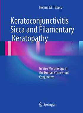 预订 Keratoconjunctivitis Sicca and Filamentary Keratopathy