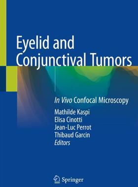 【预订】Eyelid and Conjunctival Tumors 9783030366087