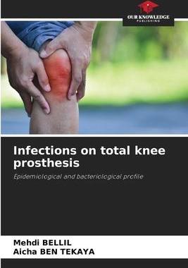 [预订]Infections on total knee prosthesis 9786205983775