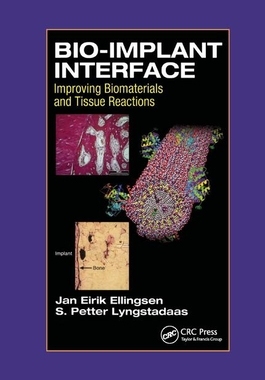 【预订】Bio-Implant Interface