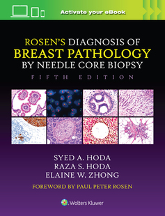 Breast Core Rosen’s Biopsy Needle Diagnosis 预订 Pathology