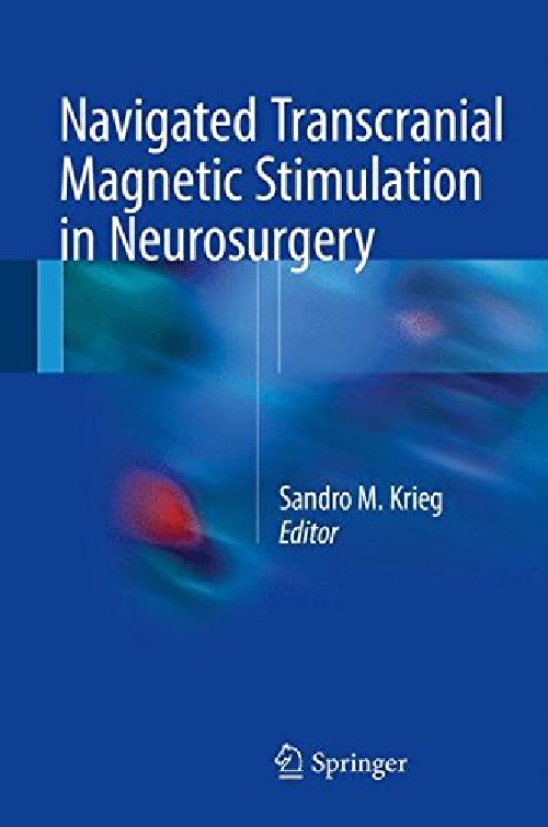 【预订】Navigated Transcranial Magnetic Stim...