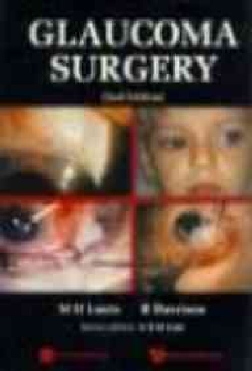 【预订】Glaucoma Surgery, 2/e
