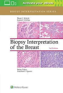 预订 the Biopsy Breast... Interpretation