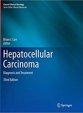 【预售】Hepatocellular Carcinoma: Diagnosis ...