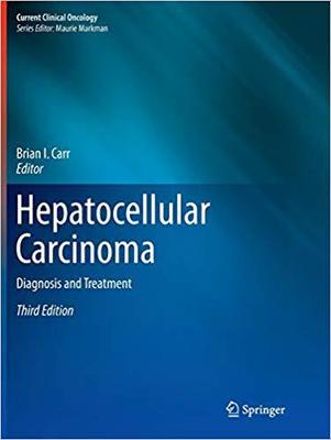 【预售】Hepatocellular Carcinoma: Diagnosis ...