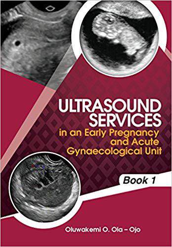 【预售】Ultrasound Services in an Early Preg...