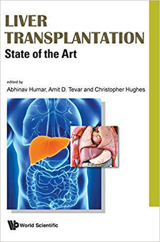 【预售】Liver Transplantation