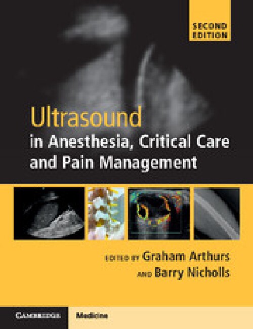 【预订】Ultrasound in Anesthesia, Critical C...