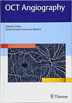 【预售】OCT Angiography