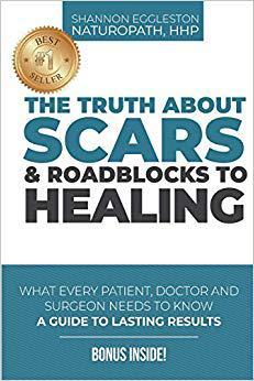 【预售】The Truth about Scars and Roadblocks...