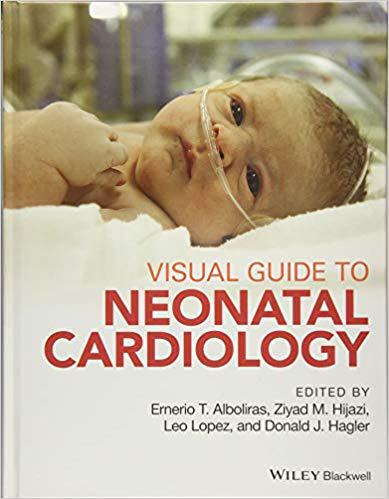 美国库房发货,通常付款后5-8周到货!